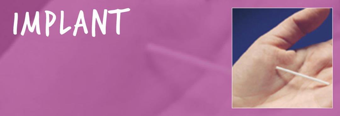 Contraceptive implant